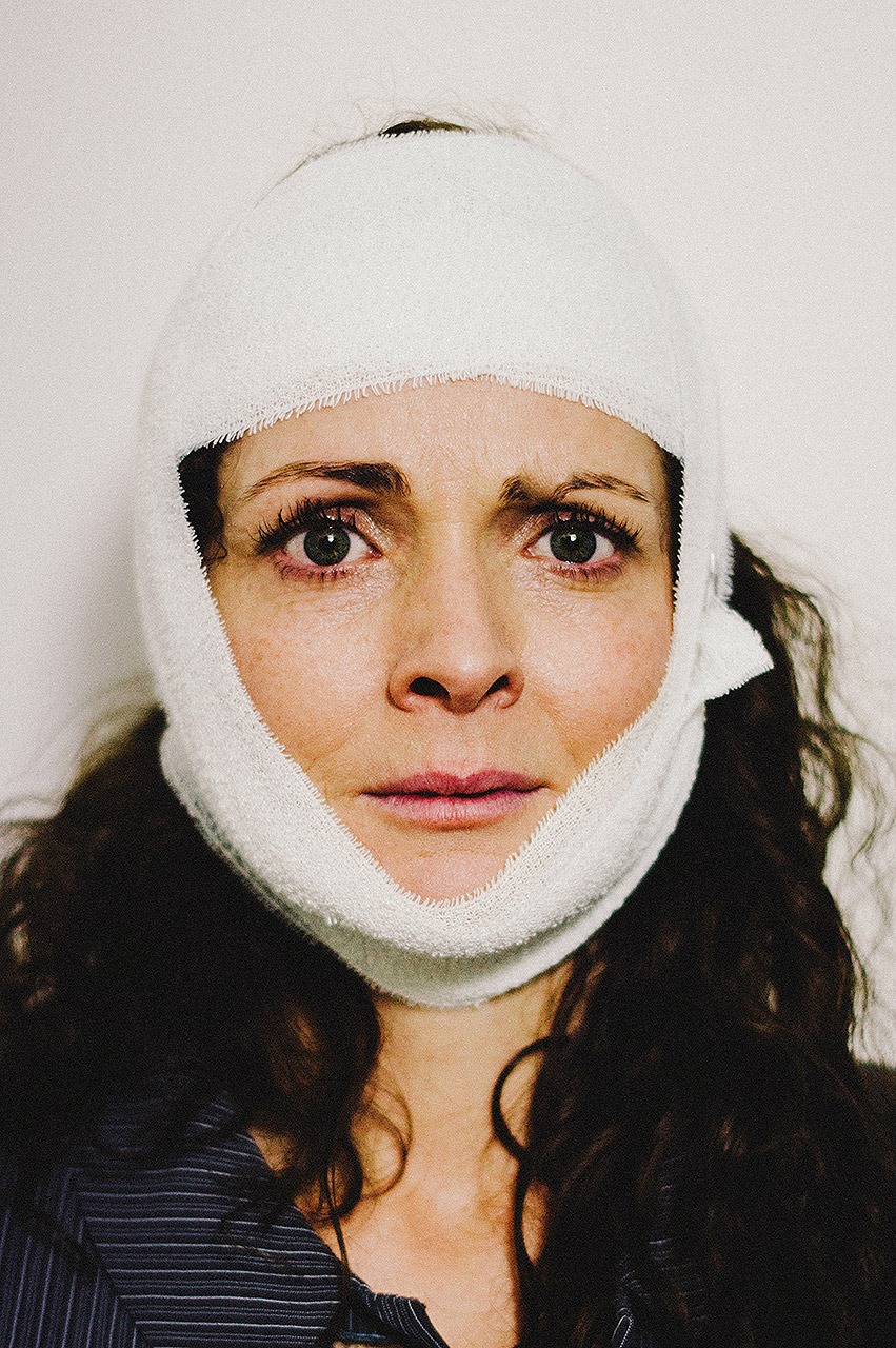 concussion-4
